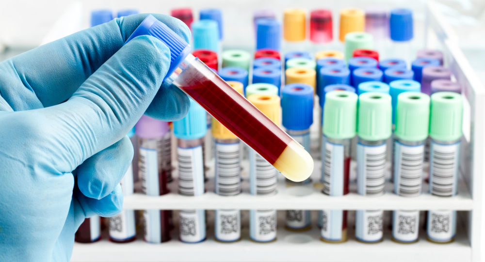 فحص بسيط يمكنه رصد أخطر أمراض