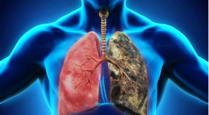 كيف تنظف رئتيك من النيكوتين؟