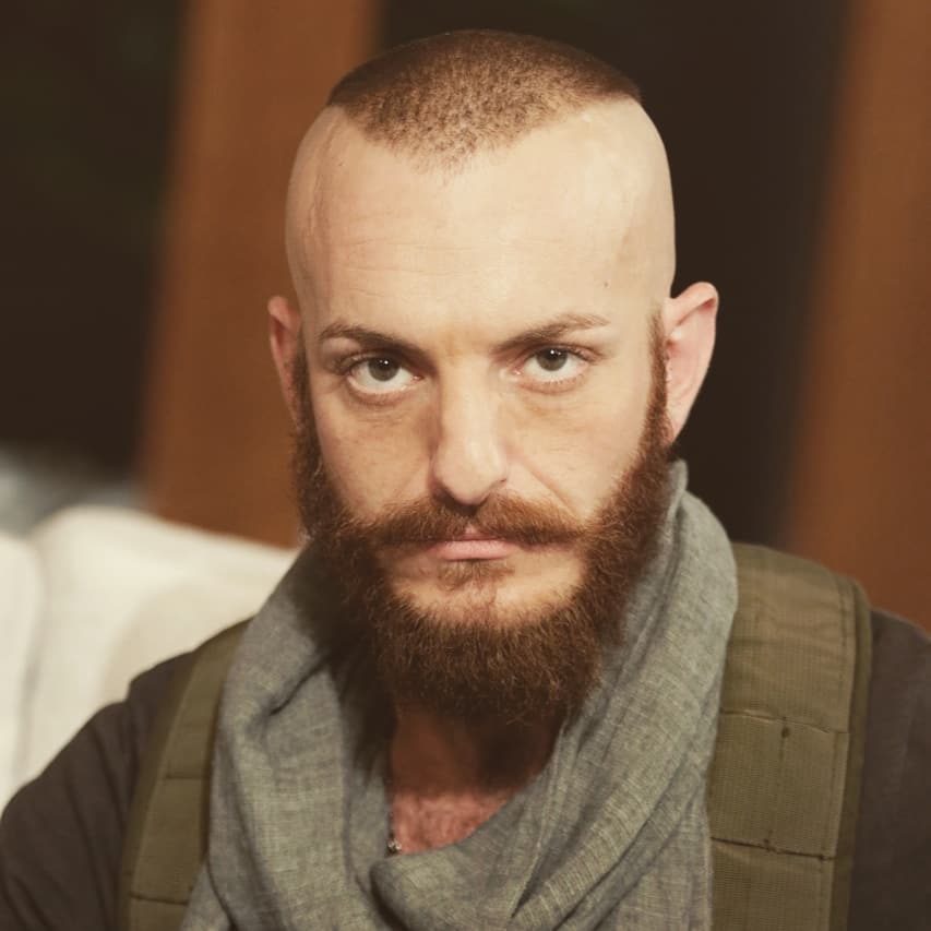 الفنان السوري أويس مخللاتي يتعرض لحادث