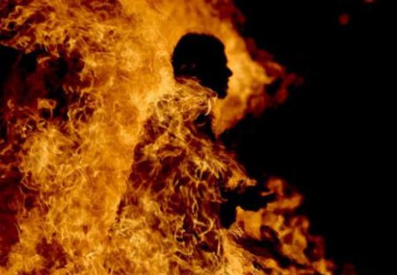 الزرقاء.. مواطن يحرق نفسه لخلافات عائلية