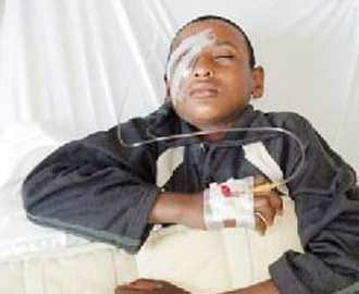 طفل فقد عينه بعصا استاذه ومازحه