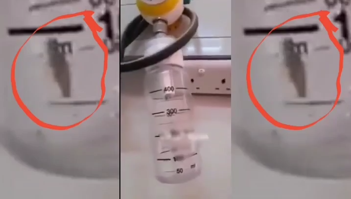 الصحة عن فيديو «الصرصور».. ليس في