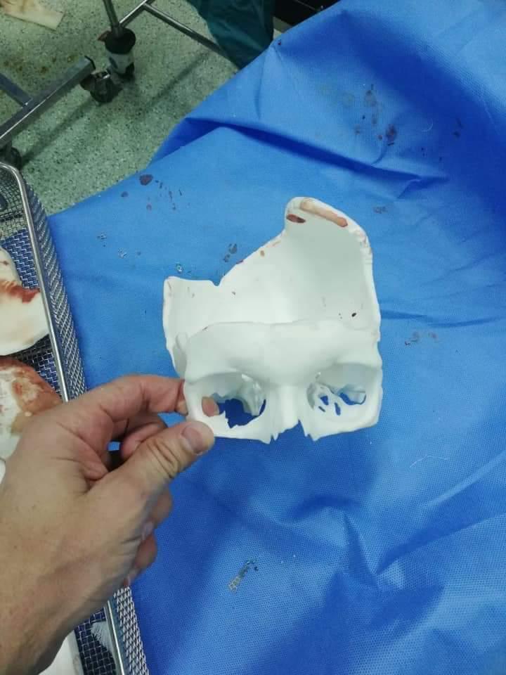 عمليات جراحية أردنيّة نادرة تمّت في