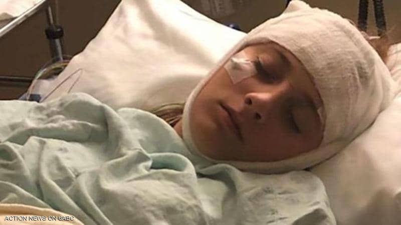 حالة طبية غريبة.. ذاكرة فتاة تعيد