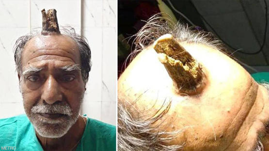 بعدما زاد عن حده.. اضطر إلى