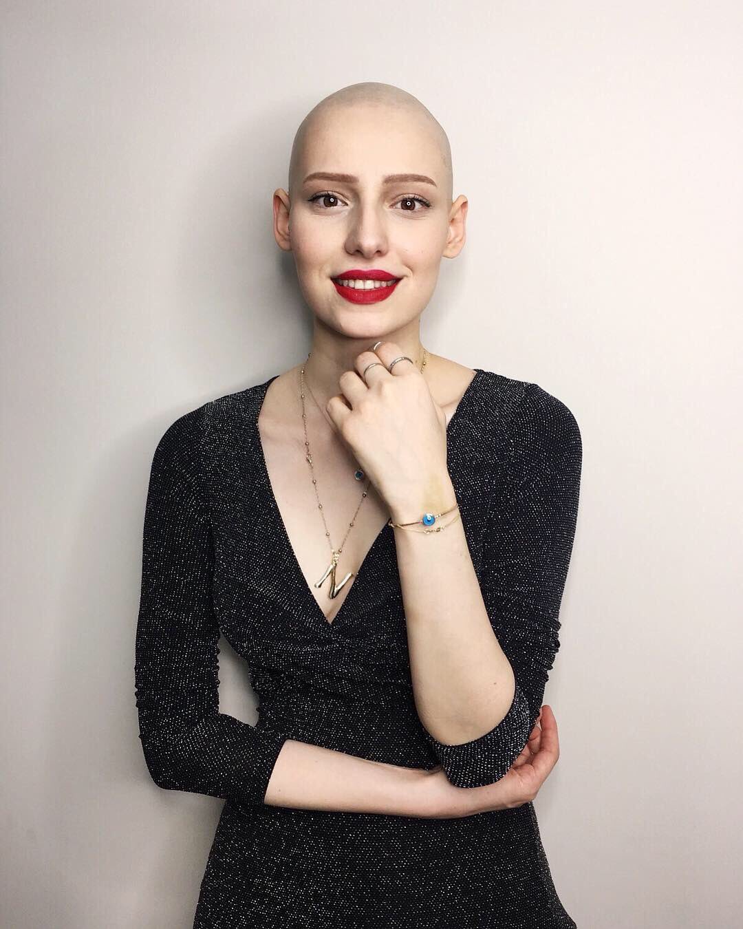 بعد انتصارها على المرض 3 مرات..