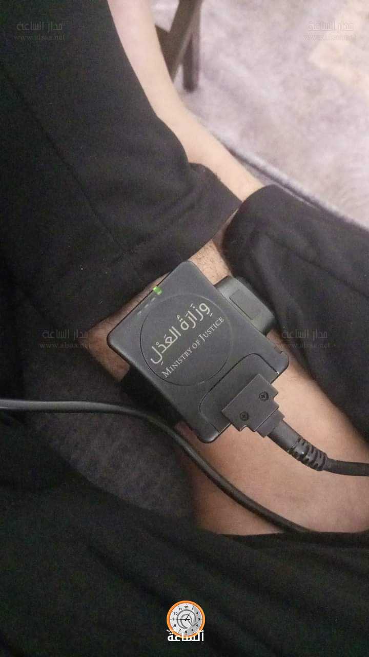 300 دينار كلفة الإسوارة الإلكترونية المستخدمة