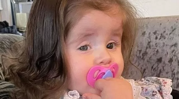 طفلة تأكل خصلات شعرها بسبب حالة