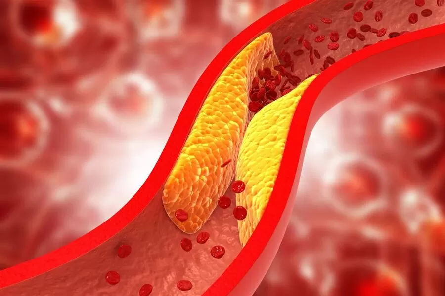 صحة القلب
ارتفاع الكوليسترول
تقليل مخاطر الأمراض القلبية