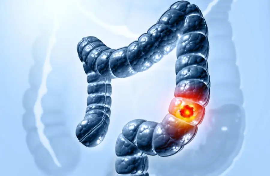 مدار الساعة,أخبار الصحة والأسرة