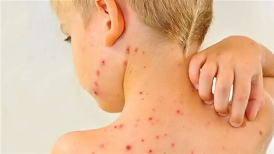 مدار الساعة,أخبار خفيفة ومنوعة,أخبار الصحة والأسرة