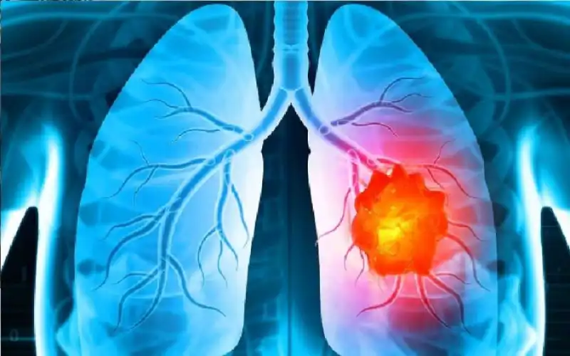 مدار الساعة,أخبار الصحة والأسرة,كورونا