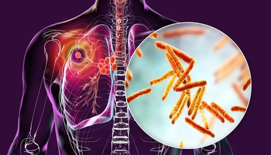 مدار الساعة,أخبار الصحة والأسرة,منظمة الصحة العالمية