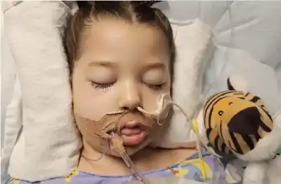 من نزهة بسيطة إلى غيبوبة: إنفلونزا