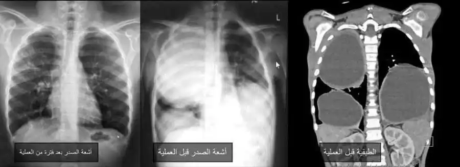 مدار الساعة,أخبار الصحة والأسرة,مستشفى الجامعة الأردنية