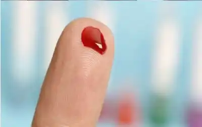 كيفية وضوء من يعاني من حبوب