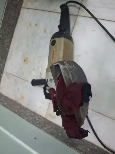 في واقعة نادرة.. استخراج منشار كهربائي