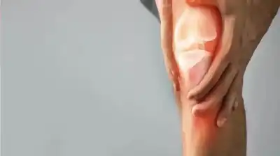 ثورة في علاج الركبة: أدوية ذكية