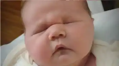 طفل الـ 6 كيلوغرامات: ولادة عملاق