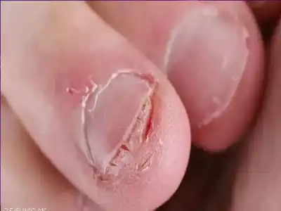 هل يخدعك عقلك؟ حقيقة الاختطاف العصبي