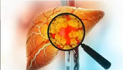 خطر يتجاوز كمية الطعام.. كيف يحول