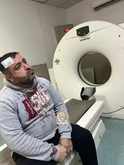 فيديو صادم.. ملثمان يهاجمان صحفيا أردنيا