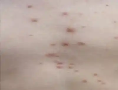 خديعة المرض غير الضار.. كيف يهدد