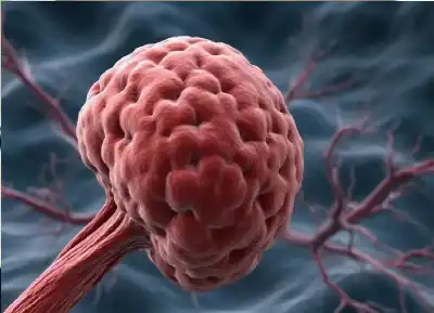 على شكل طبق لازانيا.. علماء روس