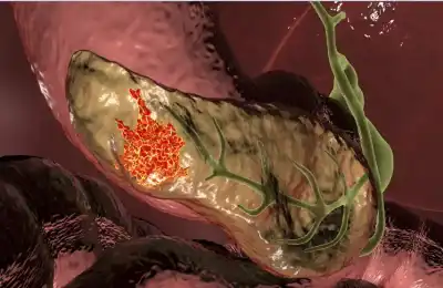 تجربة دوائية رائدة تحقق اختفاء دائما