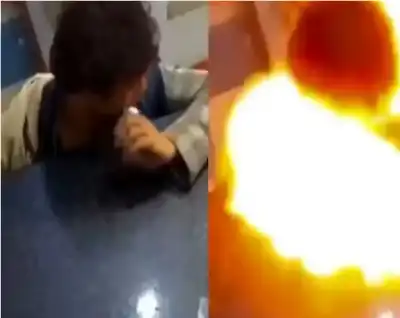 انفجرت في فمه.. مراهق هندي يحول