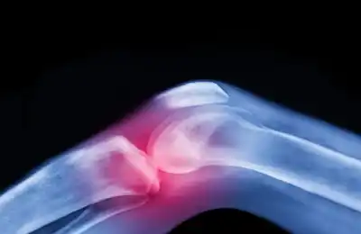 ابتكار ثوري.. ركبة بشرية حية قد