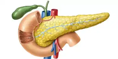 بنكرياس اصطناعي قد يغيّر علاج السكري
