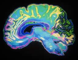 «البقعة الزرقاء» في المخ.. هل وجد
